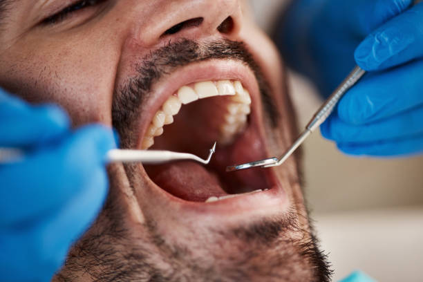 Best Knocked-Out Tooth Emergency  in Sneads Ferry, NC