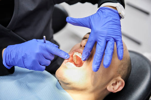 Best Chipped Tooth Repair Near Me  in Sneads Ferry, NC